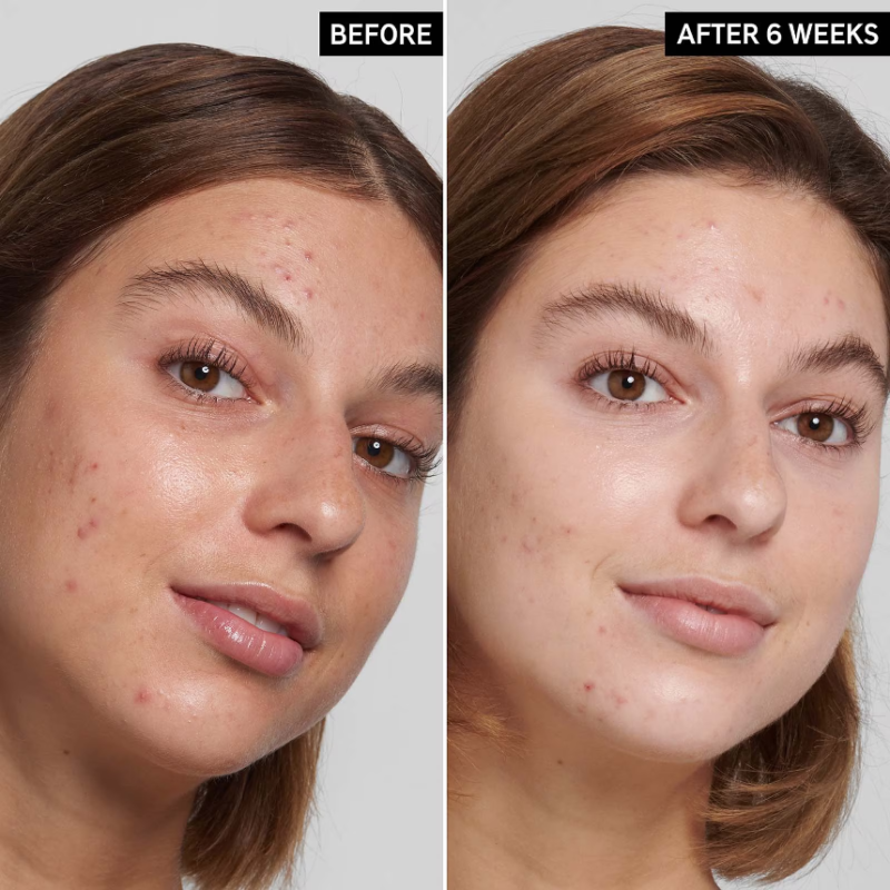 The INKEY List Salicylic Acid Cleanser 150ml - Image 2