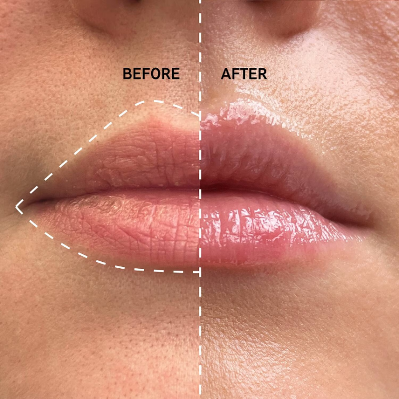 THE INKEY LIST Tripeptide Plumping Lip Balm Pink 10ml - Image 2