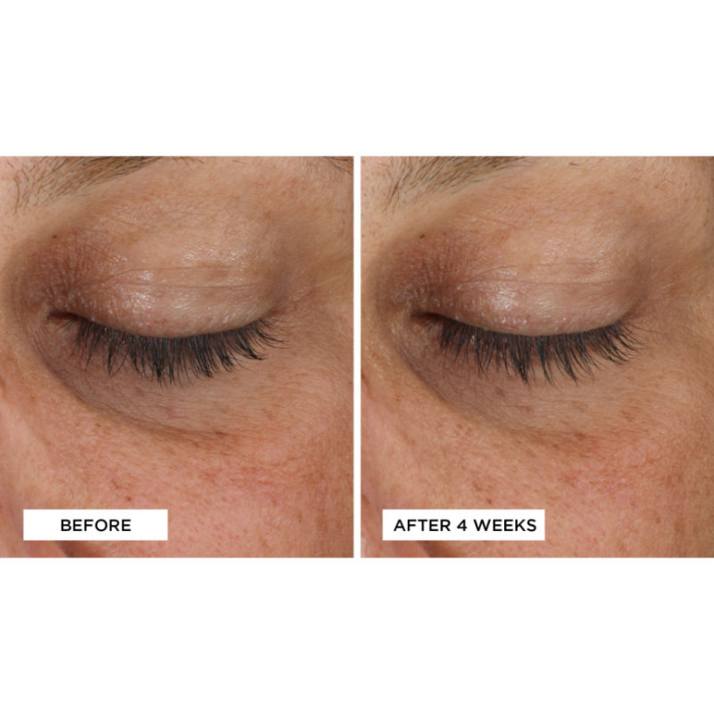 Perricone MD Cold Plasma Plus Eye 15ml - Image 5