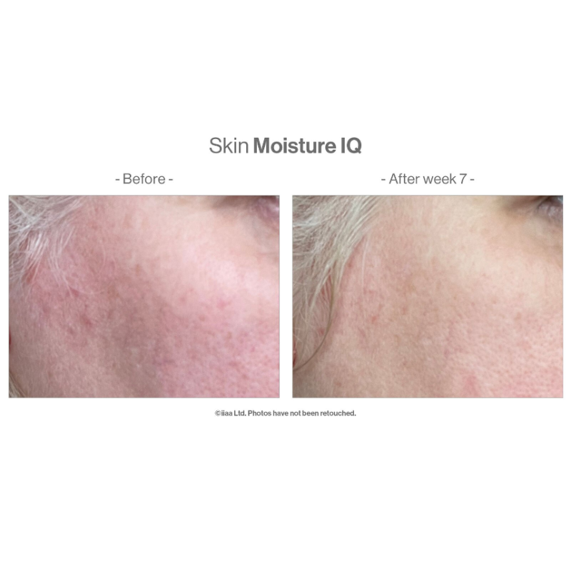 Advanced Nutrition Programme Skin Range Skin Moisture IQ 140 Capsules - Image 3
