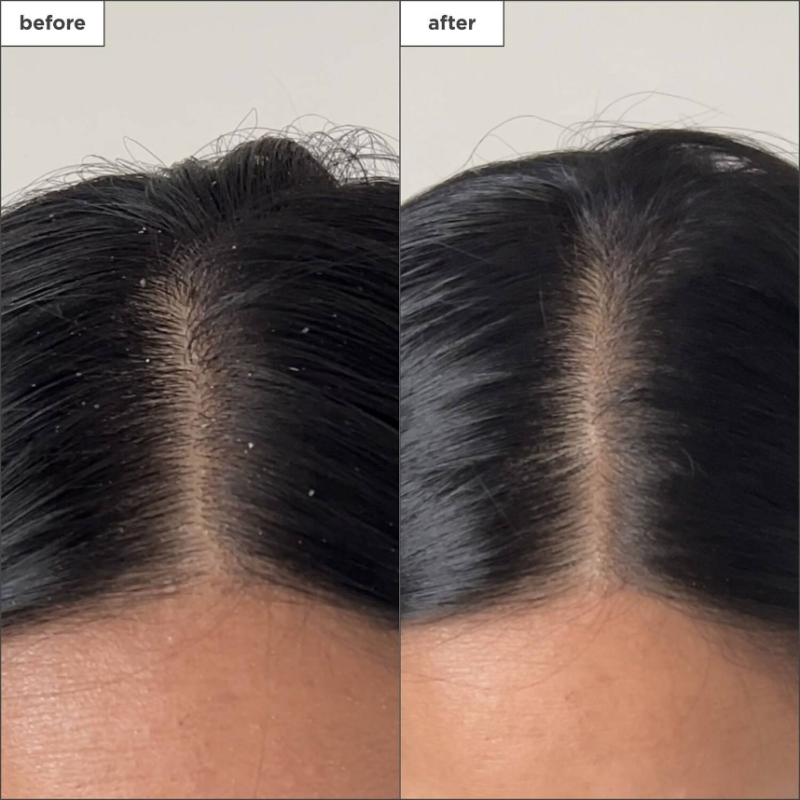 BRIOGEO Scalp Revival™ Charcoal + Tea Tree Buildup Detox Spray 120ml - Image 2