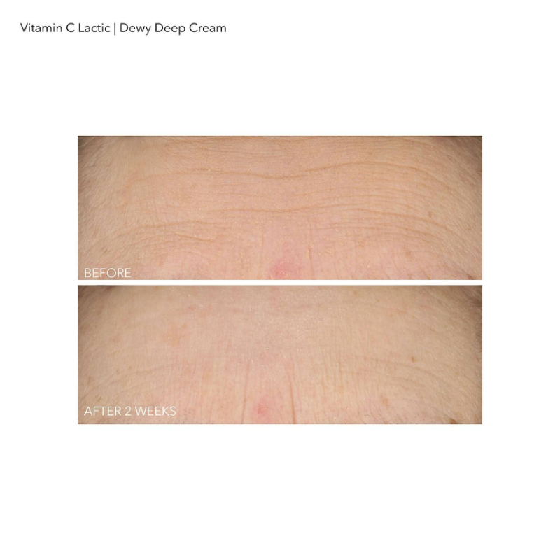 Dr Dennis Gross Skincare Vitamin C + Lactic Dewy Deep Cream - 60ml - Image 3