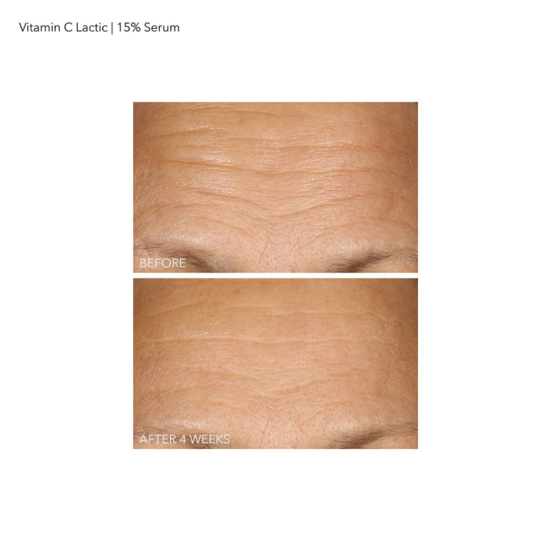 Dr Dennis Gross Skincare Vitamin C + Lactic 15% Vitamin C Firm & Bright Serum - 30ml - Image 3