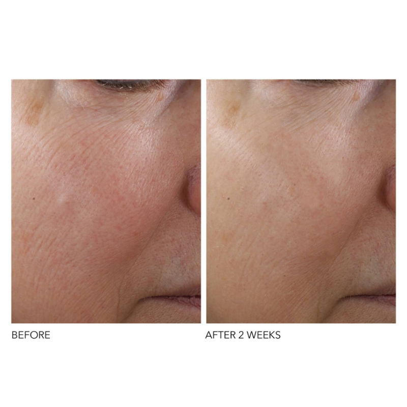 Dr Dennis Gross Advanced Retinol + Ferulic Overnight Texture Renewal Peel 16 Treatments - Image 3