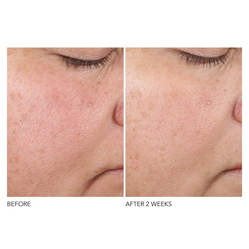 Dr Dennis Gross Advanced Retinol + Ferulic Overnight Texture Renewal Peel 16 Treatments - Image 4