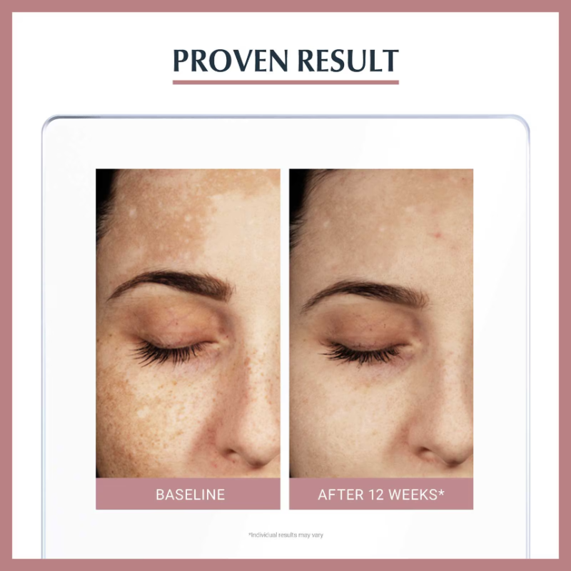 Eucerin Anti-Pigment Dual Serum - Image 4