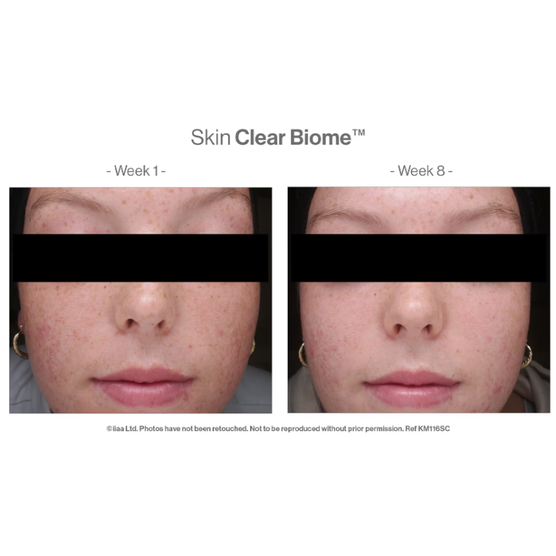 Advanced Nutrition Programme™ Skin Clear Biome x 60 Capsules - Image 2