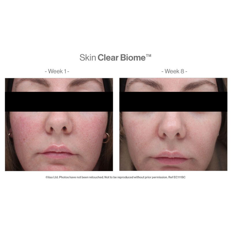 Advanced Nutrition Programme™ Skin Clear Biome x 60 Capsules - Image 3