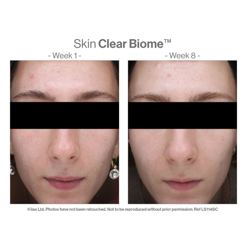 Advanced Nutrition Programme™ Skin Clear Biome x 60 Capsules - Image 4