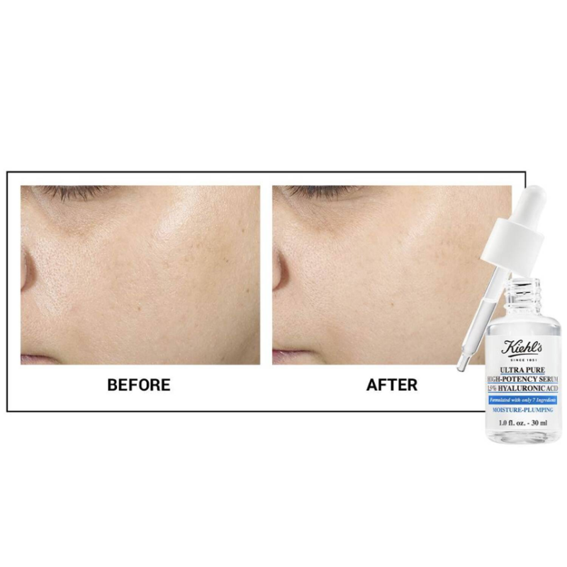 KIEHL'S SINCE 1851 Ultra Pure High-Potency Serum 1.5% Hyaluronic Acid 30ml - Image 3