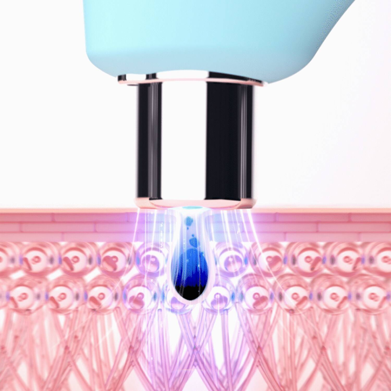 FOREO KIWI™ Blackhead Remover Pore Vacuum - Image 3