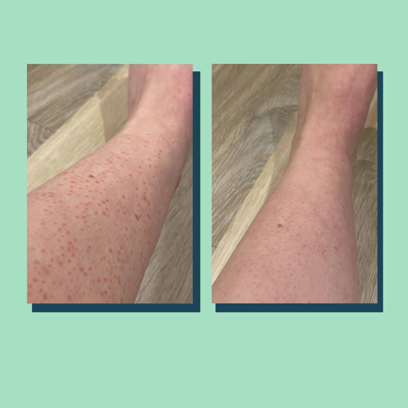LUNA DAILY The Everywhere Exfoliator 3% AHA exfoliator 180ml - Image 3